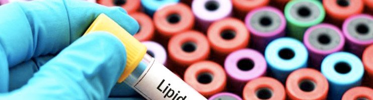 Misurazione profilo lipidico